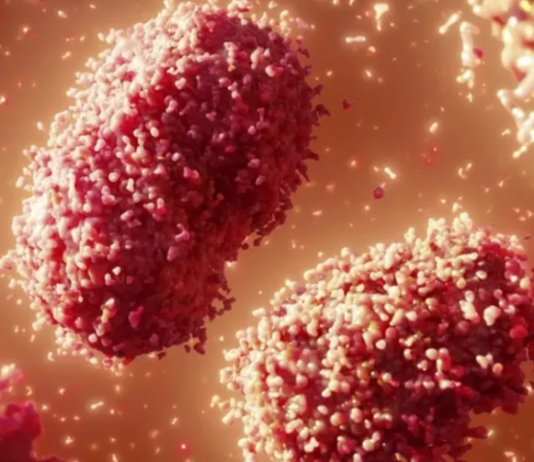 VIRUELA DEL MONO: Confirmaron el primer caso del virus en el país.