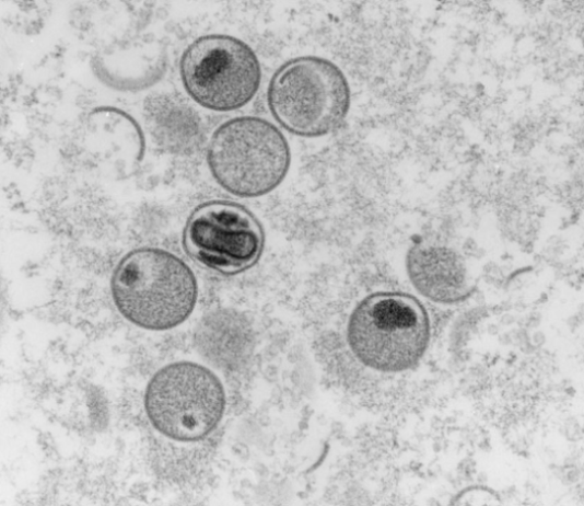 ALARMA EN LA REGIÓN: Confirman el primer caso de la viruela del mono en Brasil