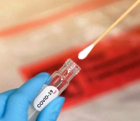 COVID-19: Fallecieron dos personas en la última semana.