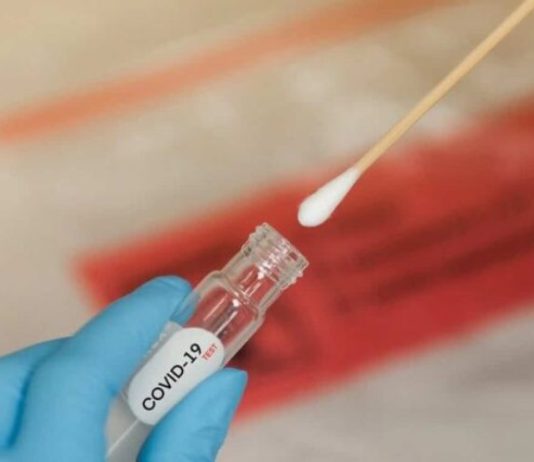 Informe COVID: Se diagnosticaron 26 casos en la última semana