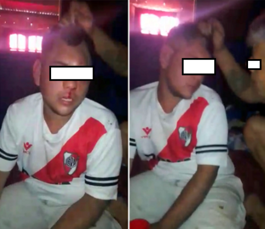 EL ESPINILLO: Jorge Jojot cuestionó el mensaje hipócrita del HCD sobre la brutal agresión a un joven.