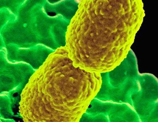 Se detectó una superbacteria resistente a 30 antibióticos en pacientes de Argentina