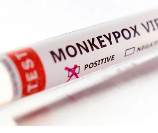 Confirman el primer caso de Viruela Símica en Formosa: se trata de un joven de 23 años