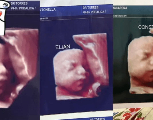 FORMOSA: Una clínica usaba la foto de la misma ecografía para todas las embarazadas