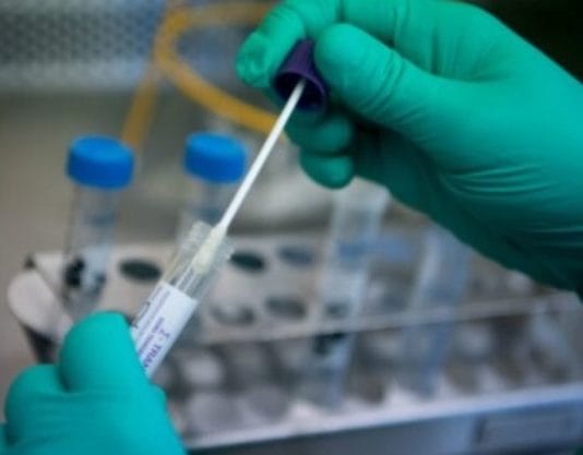 Advierten por aumento de casos de dengue y coronavirus en la provincia