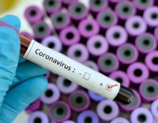 Se registraron 387 casos positivos de COVID-19 en la provincia