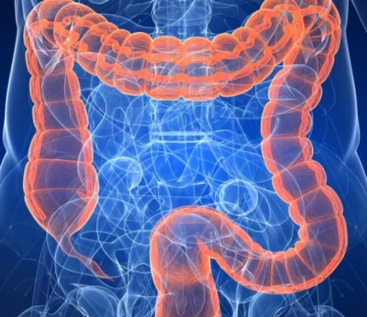 SALUD: Un doctor de Harvard revela el alimento que se debe consumir para prevenir el cáncer de colon