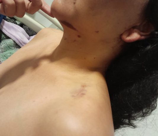 LAGUNA BLANCA: Una mujer que fue golpeada por su pareja teme por su vida al quedar libre el agresor.
