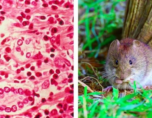 Hantavirus: hay 45 contagios confirmados en el país y crecieron los casos en la provincia de Buenos Aires